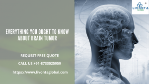 Everything You Ought to Know About Brain Tumor