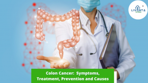 Colon Cancer: Symptoms, Treatment, Prevention and Causes
