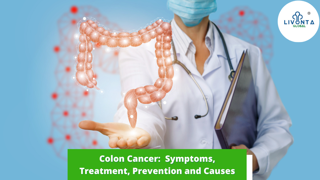 Colon Cancer: Symptoms, Treatment, and Causes