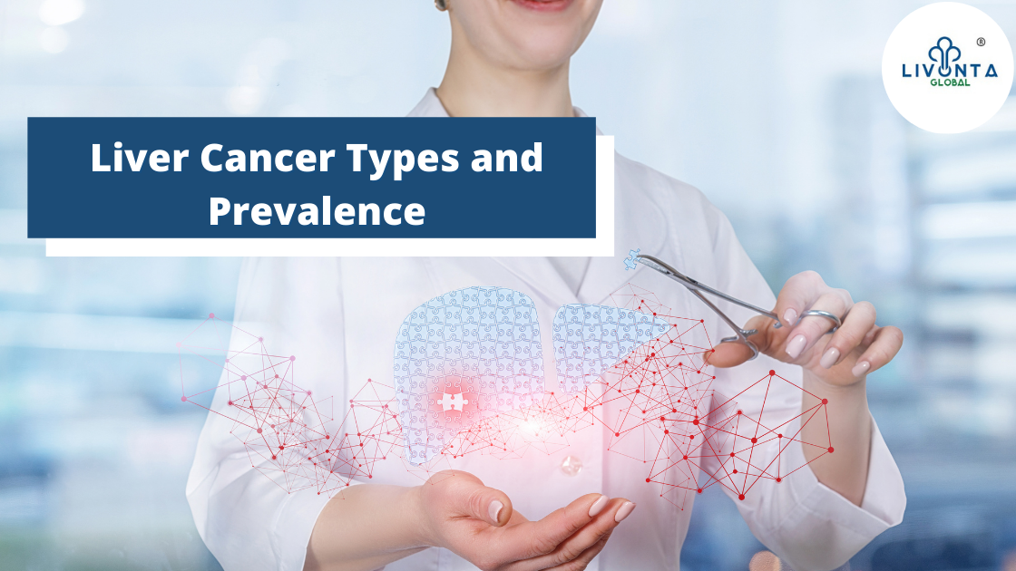 Liver Cancer Types and Prevalence