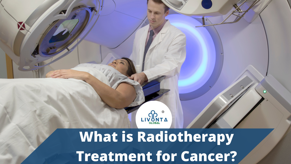 What is Radiotherapy Treatment for Cancer?