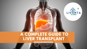 A Complete Guide To Liver Transplant And Its Procedure
