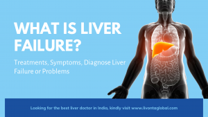 What is Liver Failure? - Treatments, Symptoms, Diagnose Liver Failure or Problems