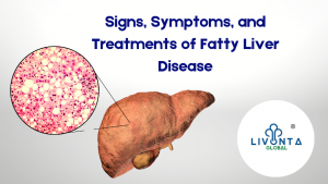 Signs, Symptoms, and Treatments of Fatty Liver Disease