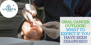 Oral cancer outlook: what to expect if you have been diagnosed