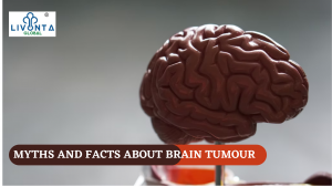 Myths and Facts about Brain Tumour