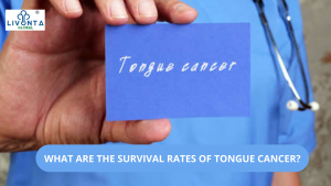 WHAT ARE THE SURVIVAL RATES OF TONGUE CANCER?