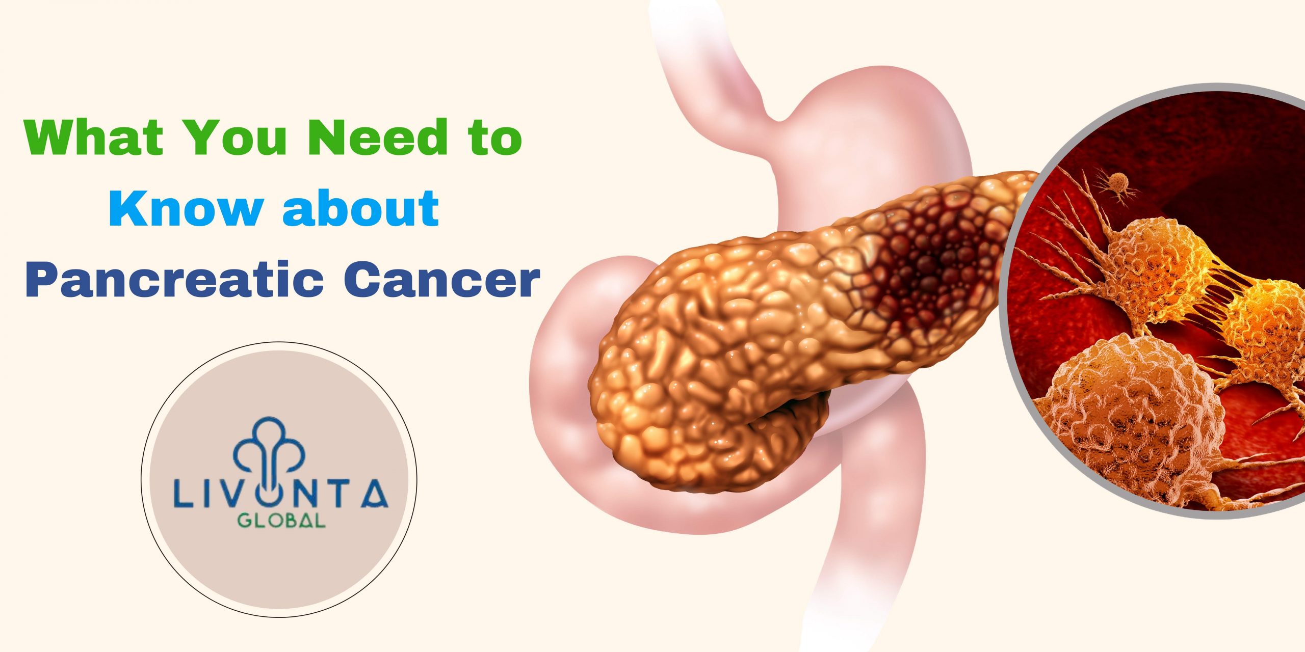 What You Need to Know about Pancreatic Cancer