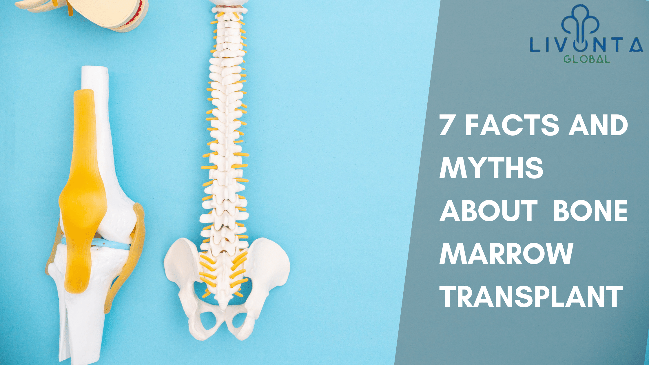 7 Facts And Myths About Bone Marrow Transplant