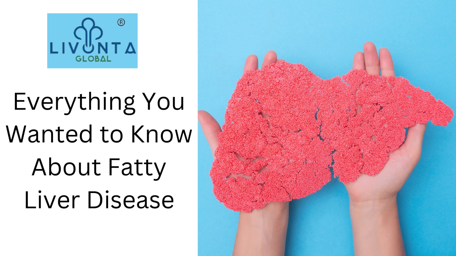 Everything You Wanted to Know About Fatty Liver Disease