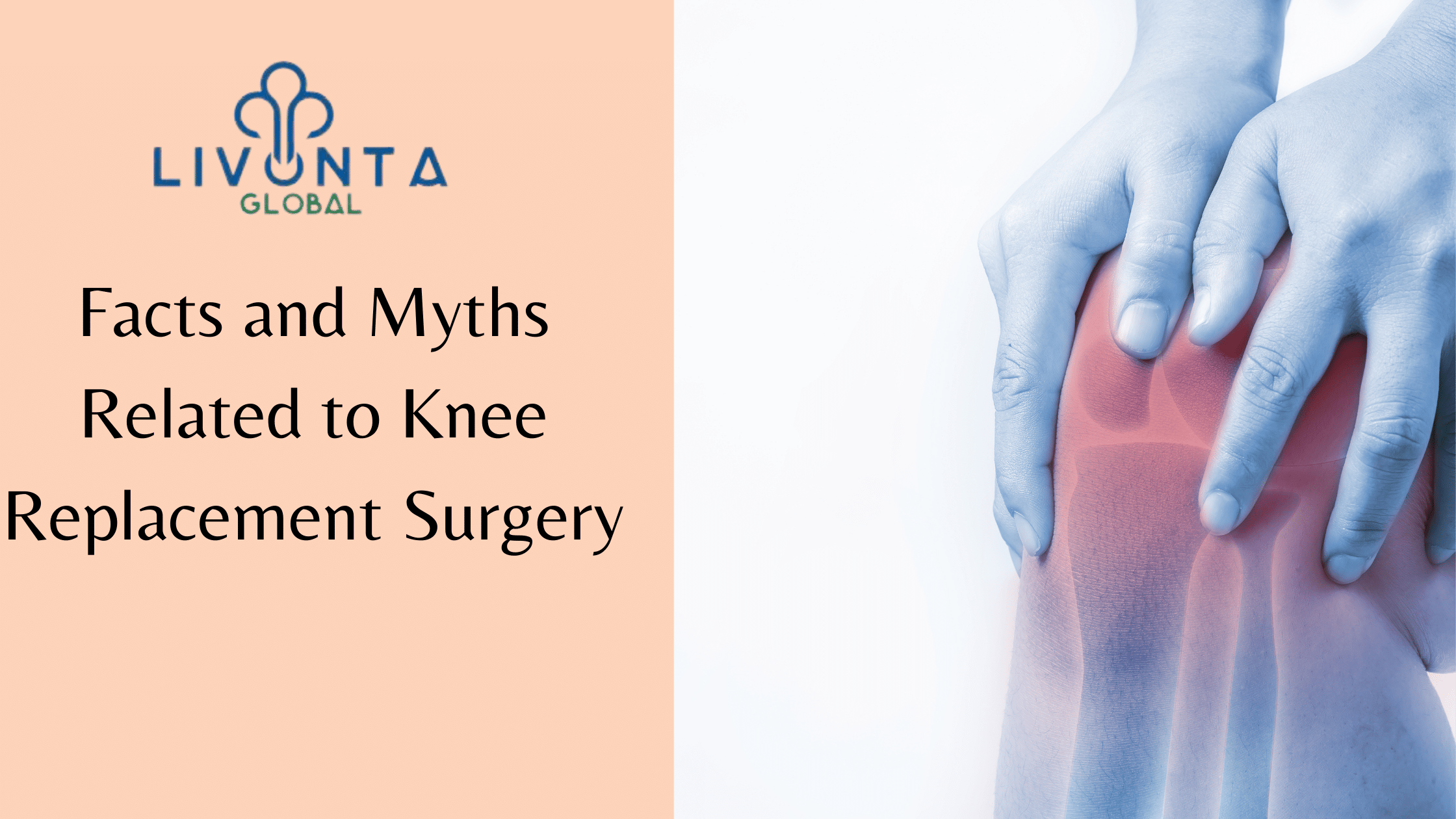 Facts and Myths Related to Knee Replacement Surgery