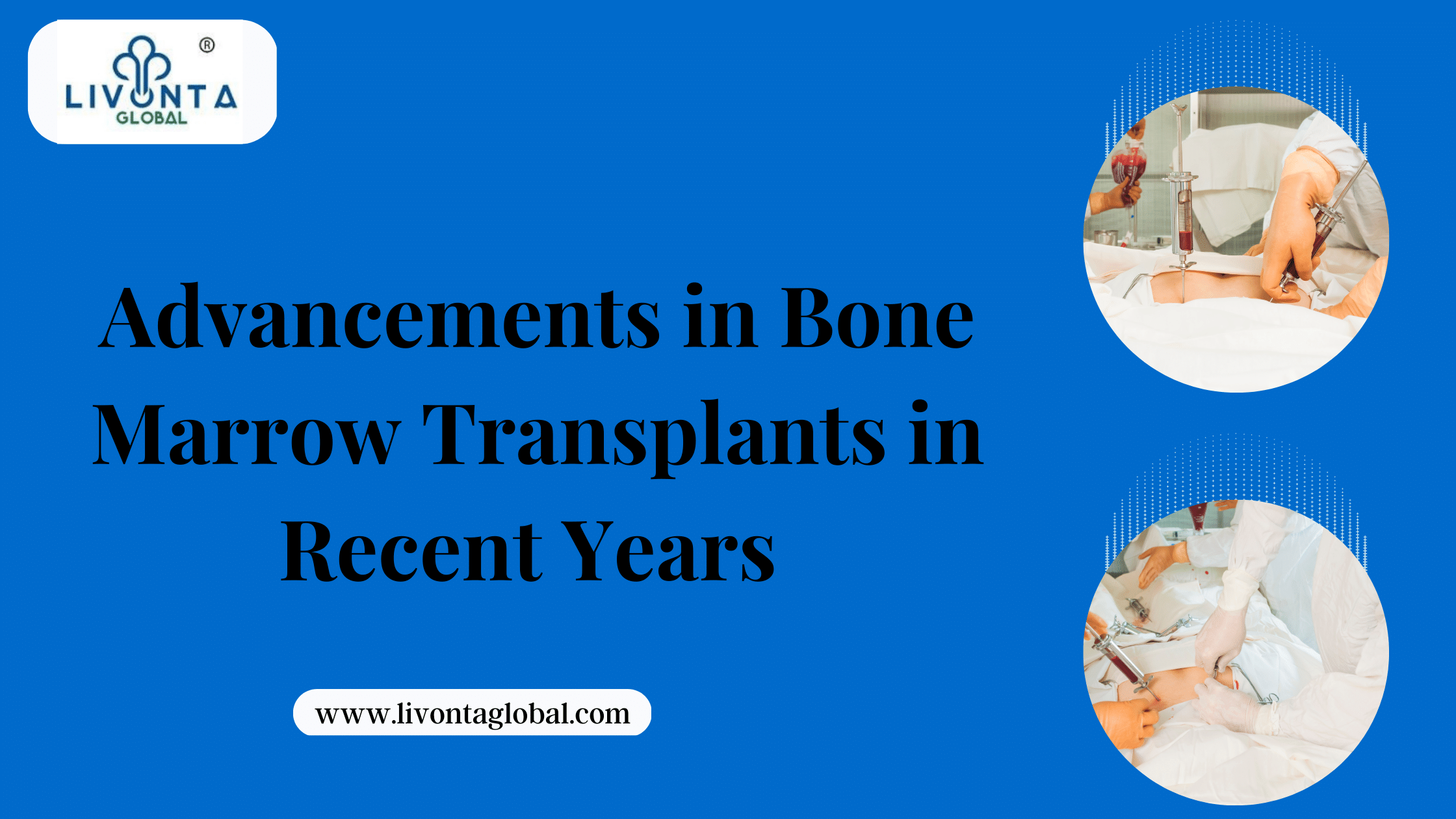 Advancements in bone marrow transplants in recent years
