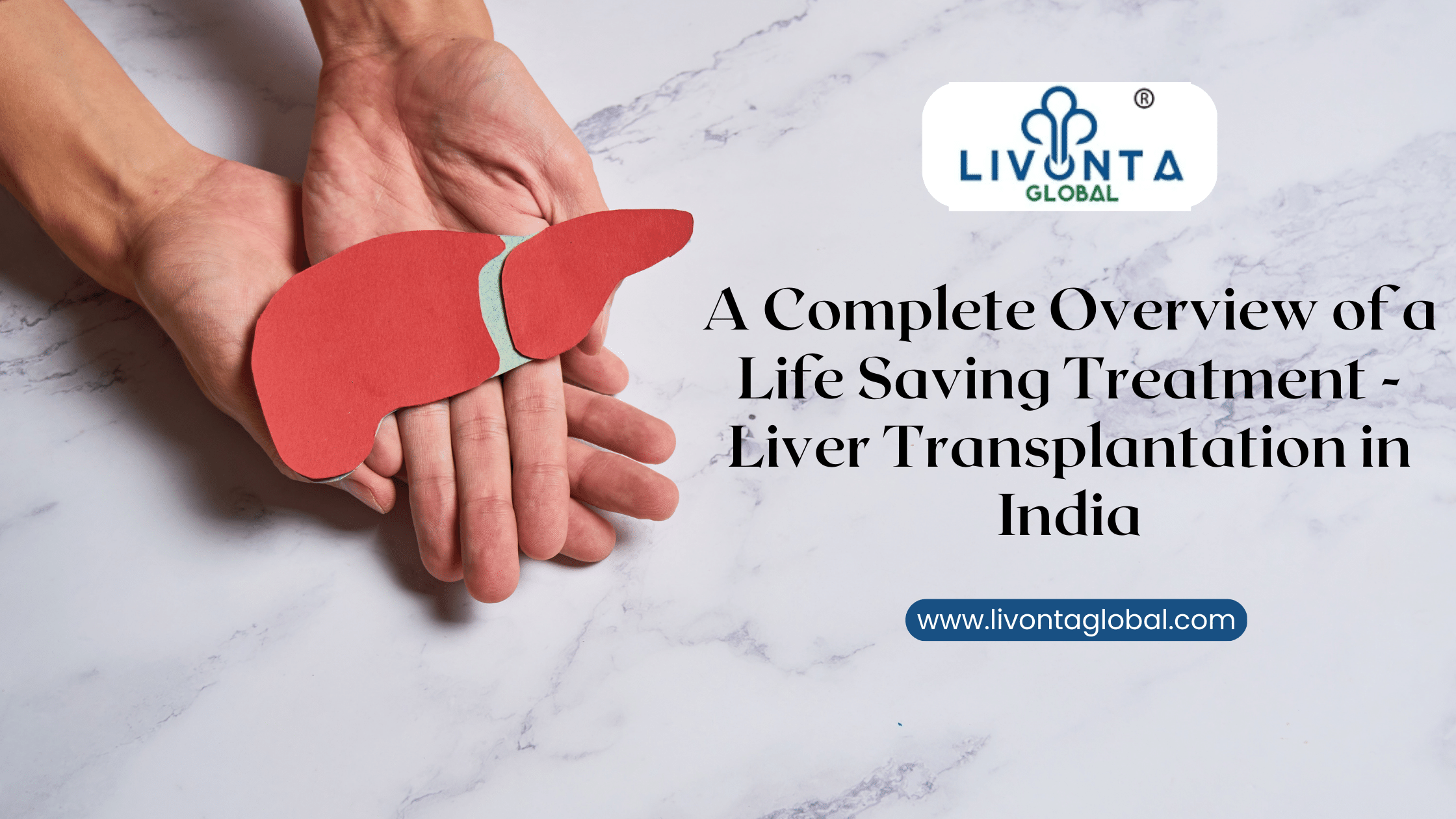 A Complete Overview of a Life Saving Treatment – Liver Transplantation in India