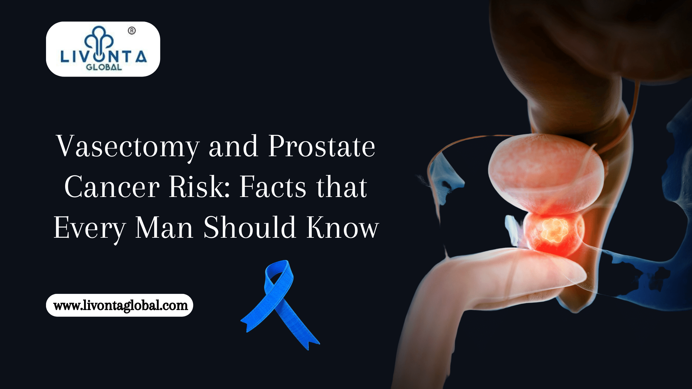 Vasectomy and Prostate Cancer Risk: Facts that Every Man Should Know