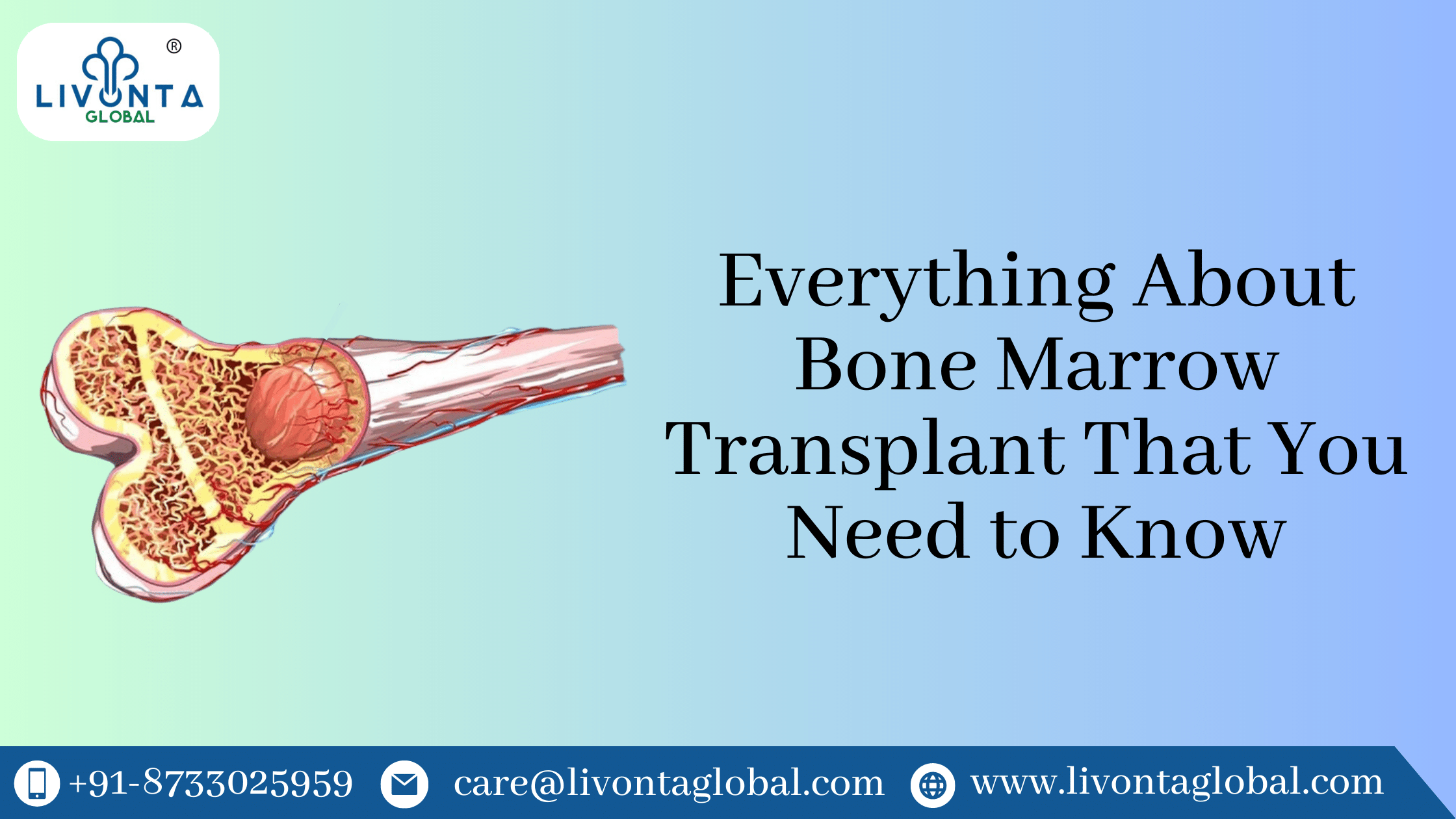 Everything About Bone Marrow Transplant That You Need to Know