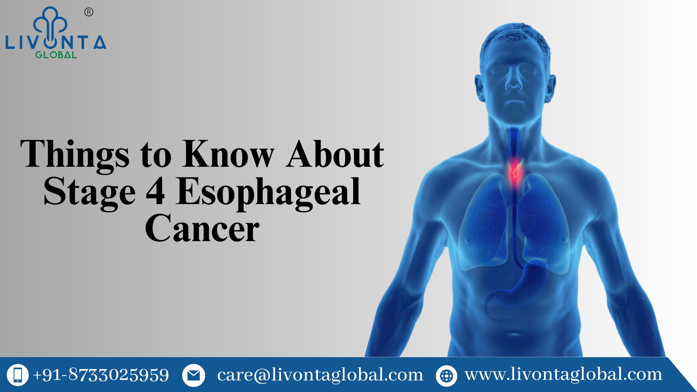 Things to Know About Stage 4 Esophageal Cancer