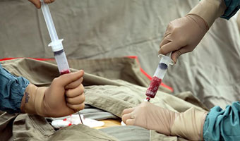 Bone Marrow Transplant (Autologous & Allogeneic)  (India)