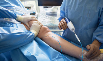 Vascular Surgeries (India)